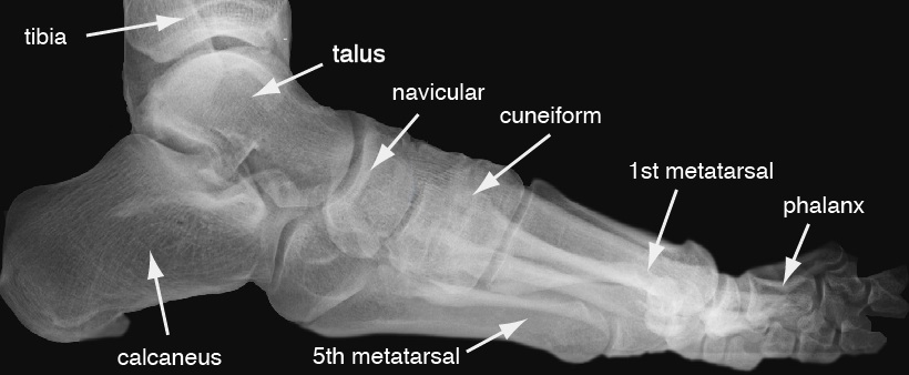 The Foot: The ‘Most Durable Part’ of our Anatomy - www.Mariemont.com