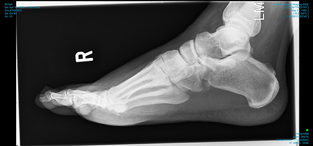 The Foot: The ‘Most Durable Part’ of our Anatomy - www.Mariemont.com